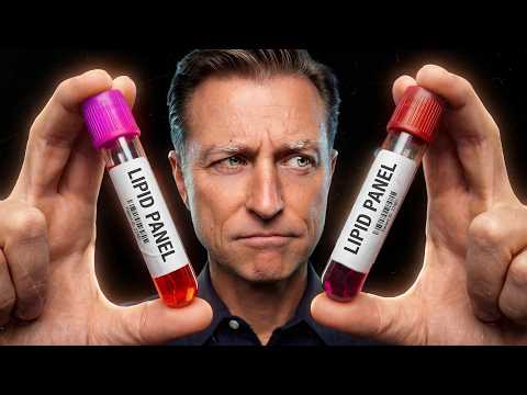 How Cholesterol Was Made Scary