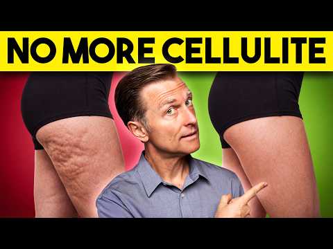 The #1 Best Way to Lose Hip & Butt Cellulite