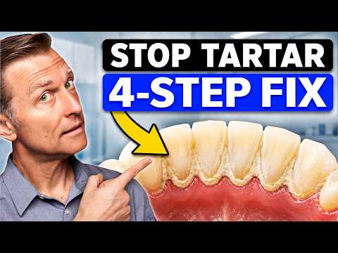 Tartar Keeps Coming Back in the Same Spot? (Here’s How to Stop It)