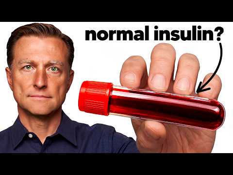 The Blood Test That Catches Diabetes 20 Years Early